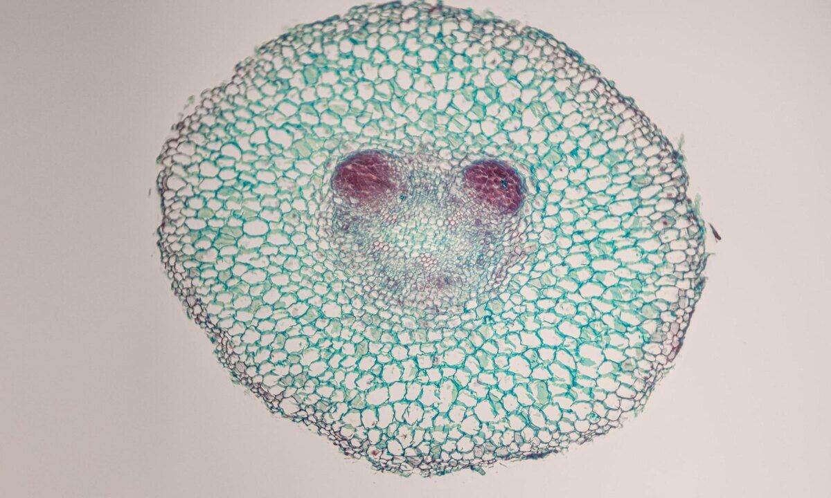 ��� ��������� ����������� ��������� ��� ������: ������� �� ��������